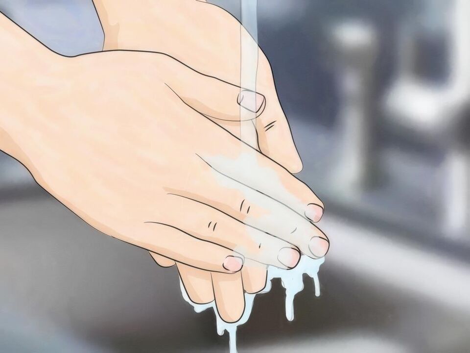 为了避免蠕虫感染，请保持良好的卫生习惯并洗手。