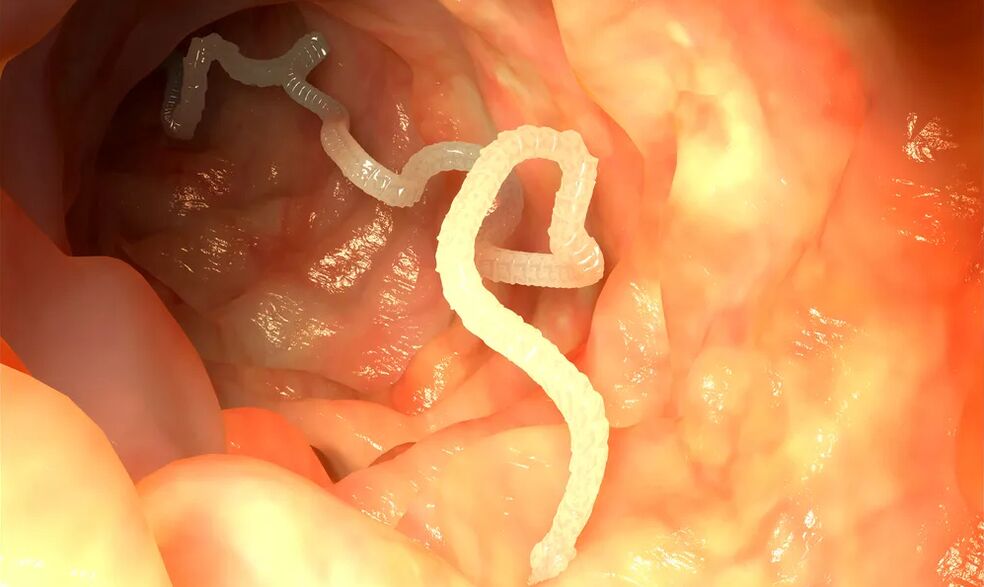 管腔蠕虫感染肠道