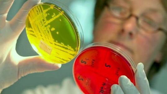 人体寄生虫检测试验的研究